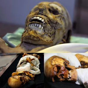 Uncovering an Ancient Genetic Anomaly Tied to Colorectal Cancer in an 18th-Century Hungarian Mummy - Breaking Discovery